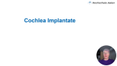 thumbnail of medium Cochlea Implantate